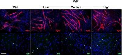 Ki67/MKI67 Antibody - BSA Free (NB110-89717) by Novus, Part